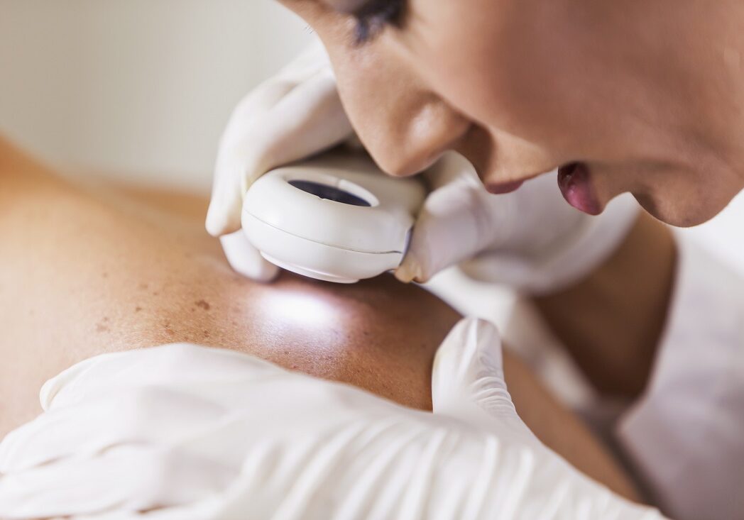 skin cancer awareness month skin cancer awareness month